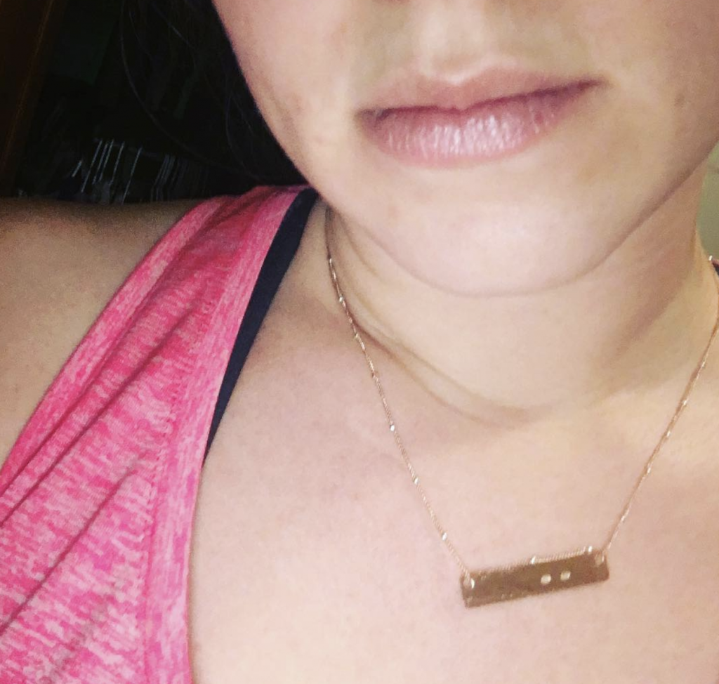miscarriage, pregnancy loss